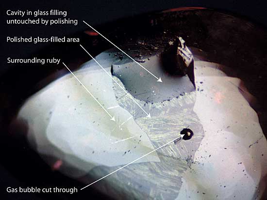 Figure 3. Surface repair (glass infilling) A large glass-filled surface cavity is clearly visible in this treated Thai/Cambodian ruby cabochon. The glass has a lower luster than the surrounding ruby, and in places has started to devitrify (crystallize). The upper portion of the filling is below the surface of the gem and so was not touched by the polishing wheel. The circular black dot in the center is a cavity resulting from a gas bubble cut through during the cutting process. Photo: R.W. Hughes