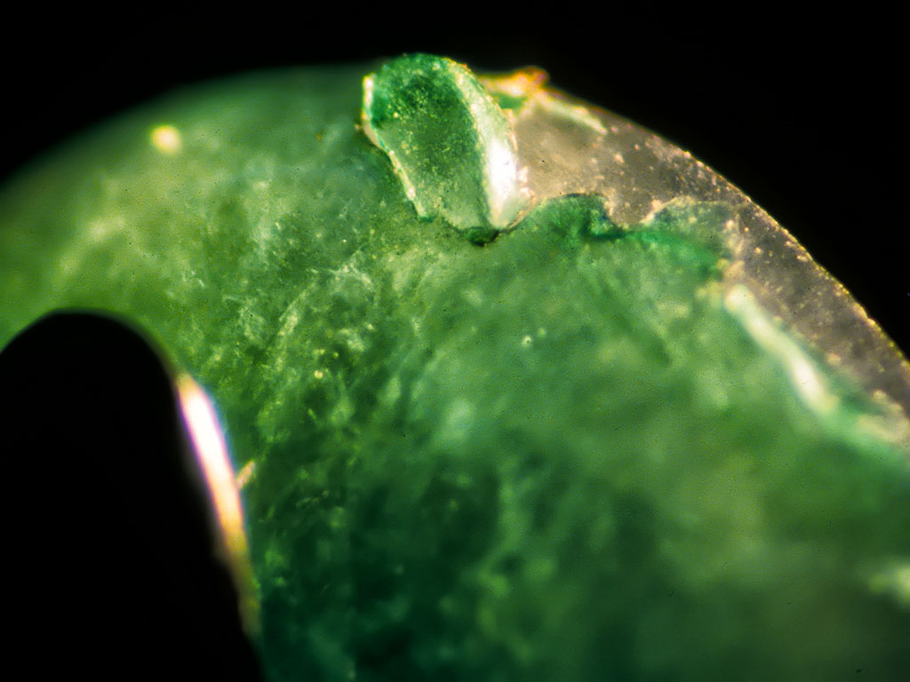 Figure 33. Top: Plastic-coated jadeite cabochons on offer in Mandalay's jade market. Bottom: A plastic-coated jadeite cabochon displays peeling of the green plastic at the girdle under magnification. Photos © Richard W. Hughes