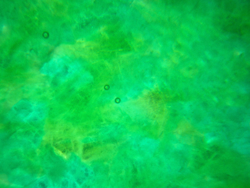 Figure 32. Top: This heart-shaped jadeite cabochon is actually hollowed out to near-eggshell thickness so that the color appears bright and lively. To protect it, the back is filled in with resin. Such stones are normally bezel set with a closed backing to hide the fraud. Bottom: Round gas bubbles are visible in the resin backing under magnification. Photos © Richard W. Hughes